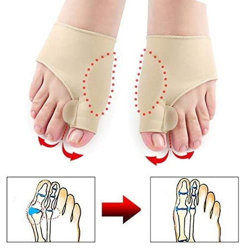 Aegon Bunion Corrector