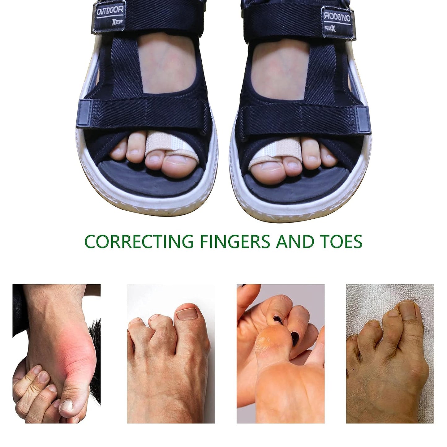 Aegon Hammer Toe Straightener