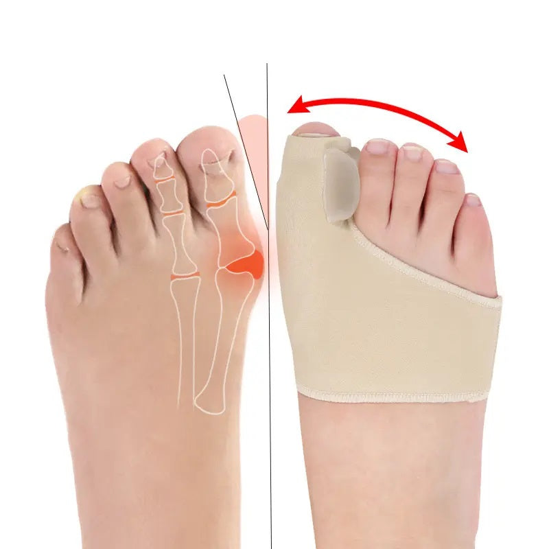 Aegon Bunion Corrector